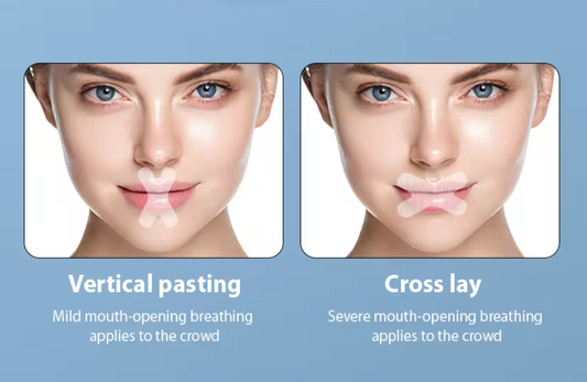 Sleepco Mouth Tape Strips for Snoring & Nasal Mask Use. X-Type 120 Pieces