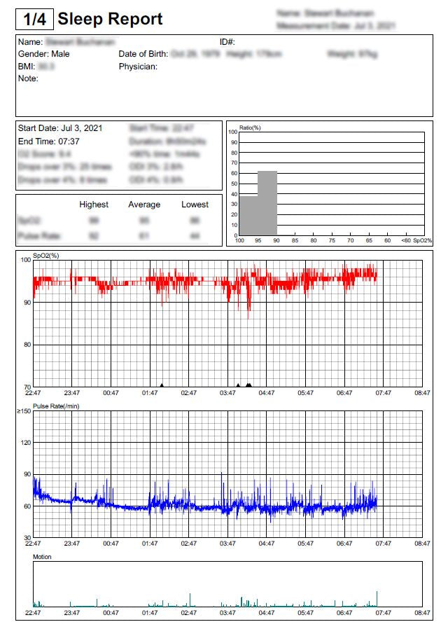 3 night Pulse Oximetry Sleep Test for Sleep Apnea detection