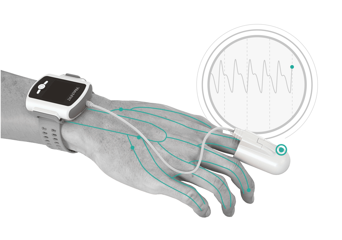 At-Home Oximetry Overnight Screening Sleep Test